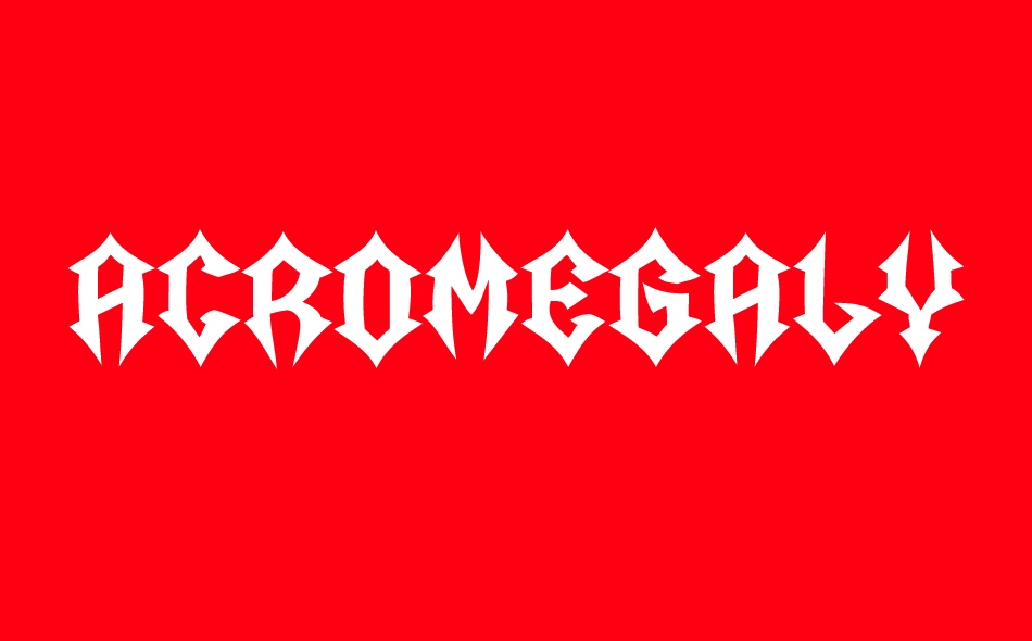 Acromegaly font big